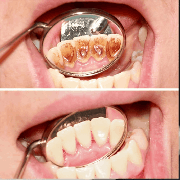 Sonic Toothbrush customer review  Mark F